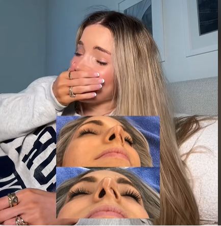 A glimpse of Isabelle Lux's collapsed nostril, seen in a post dated April 14, 2025 | Source: TikTok/@isabelle.lux