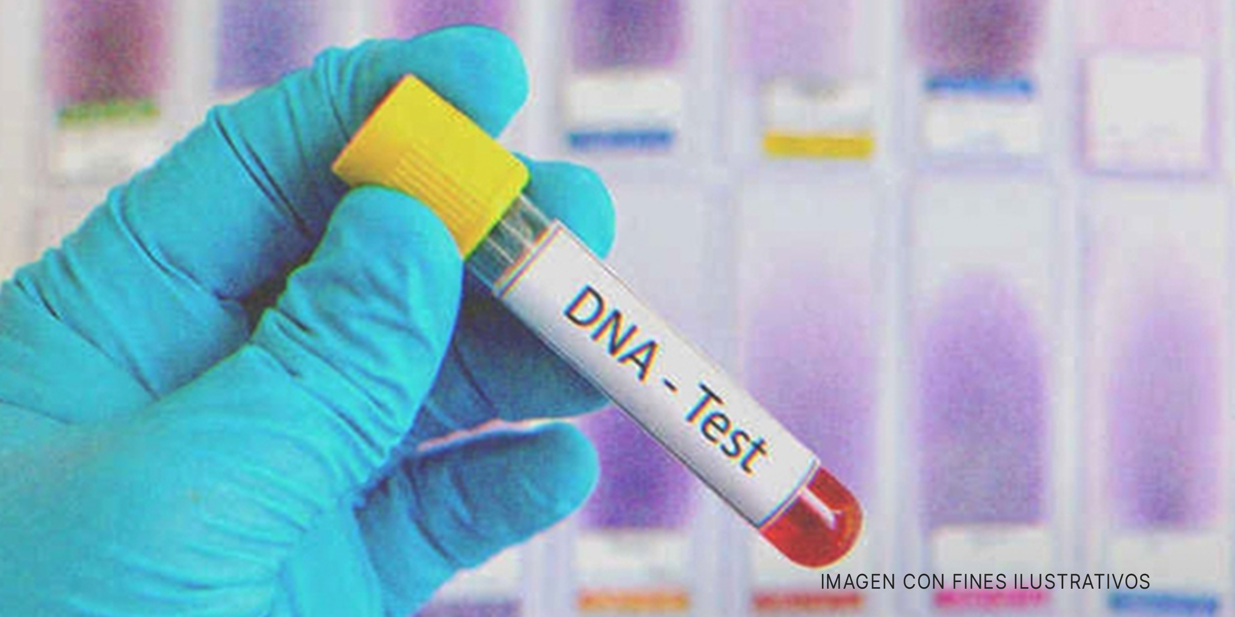Muestra para ADN | Foto: Shutterstock