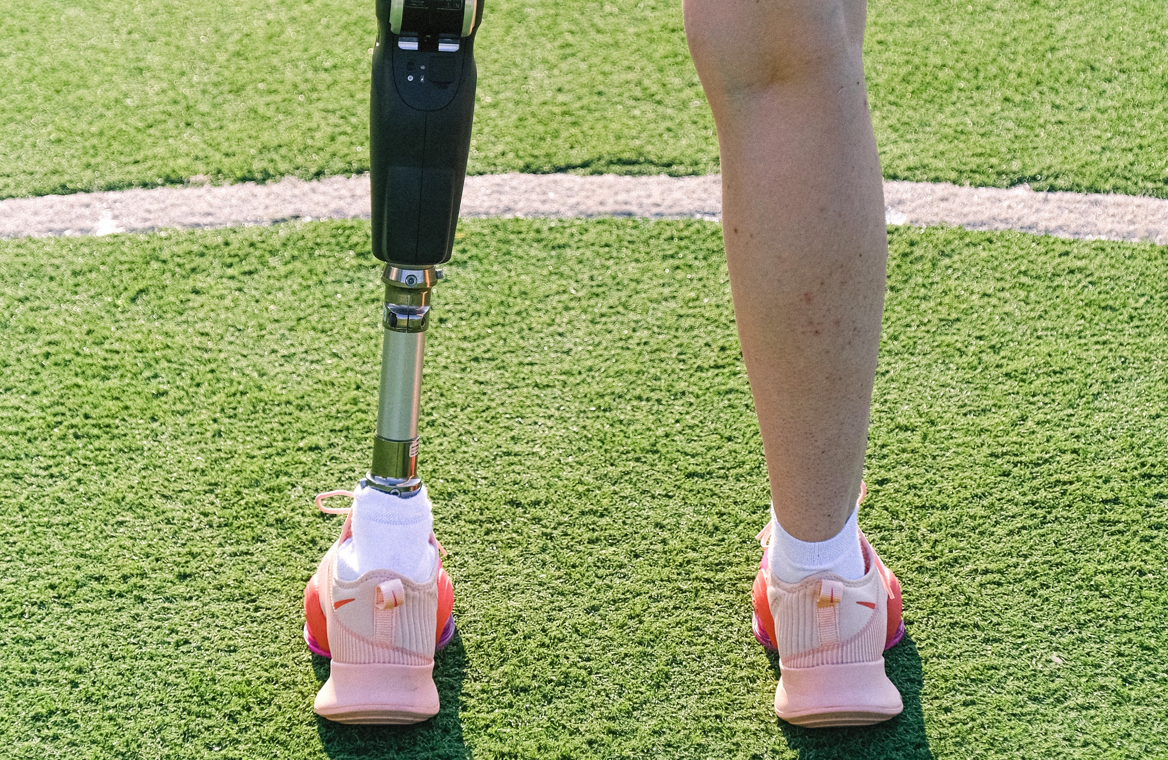 Jake und sein Team blickten auf Sam herab, als sie seine Beinprothese sahen. | Quelle: Pexels