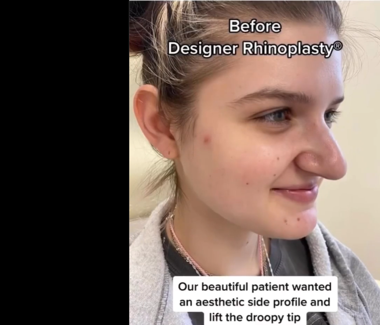 Patient pictured before the procedure, dated September 30, 2022 | Source: Instagram/drkassir