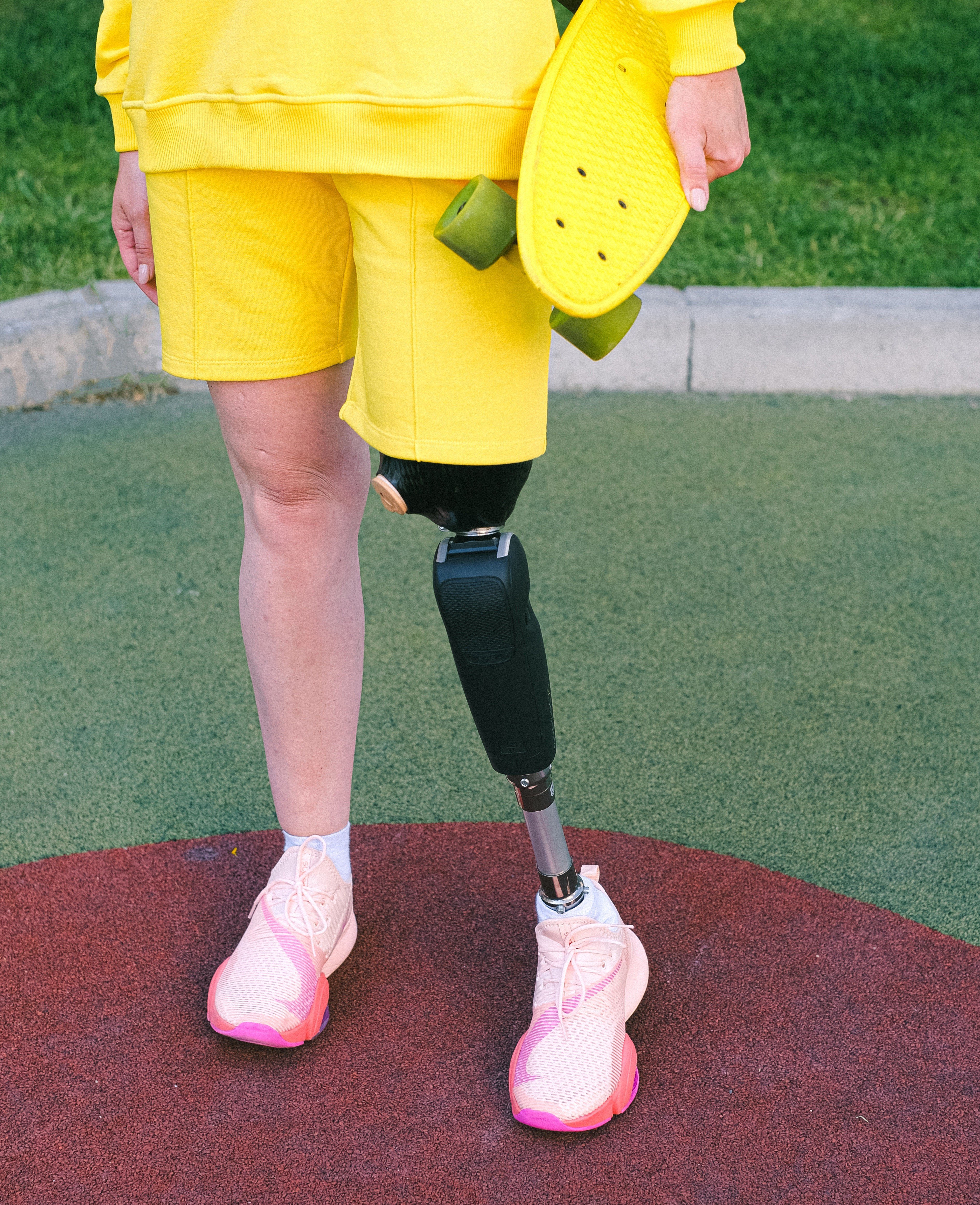 Lucy's parents paid for Heather's new prosthetic. | Source: Pexels