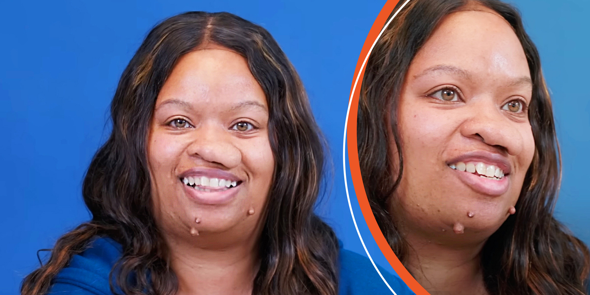 The woman with facial tumors | Source: YouTube/@Dr.Truesdale