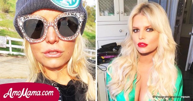 Jessica Simpson gets backlash after fans saw her lips in a recent photo