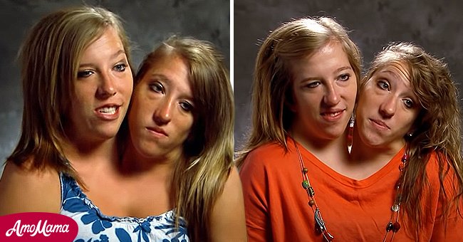 All We Know about World-Famous Conjoined Twins Abby and Brittany Hensel ...