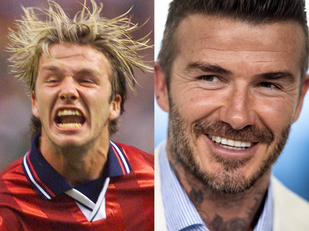 A before and after of David Beckham's smile. | Source: Getty Images