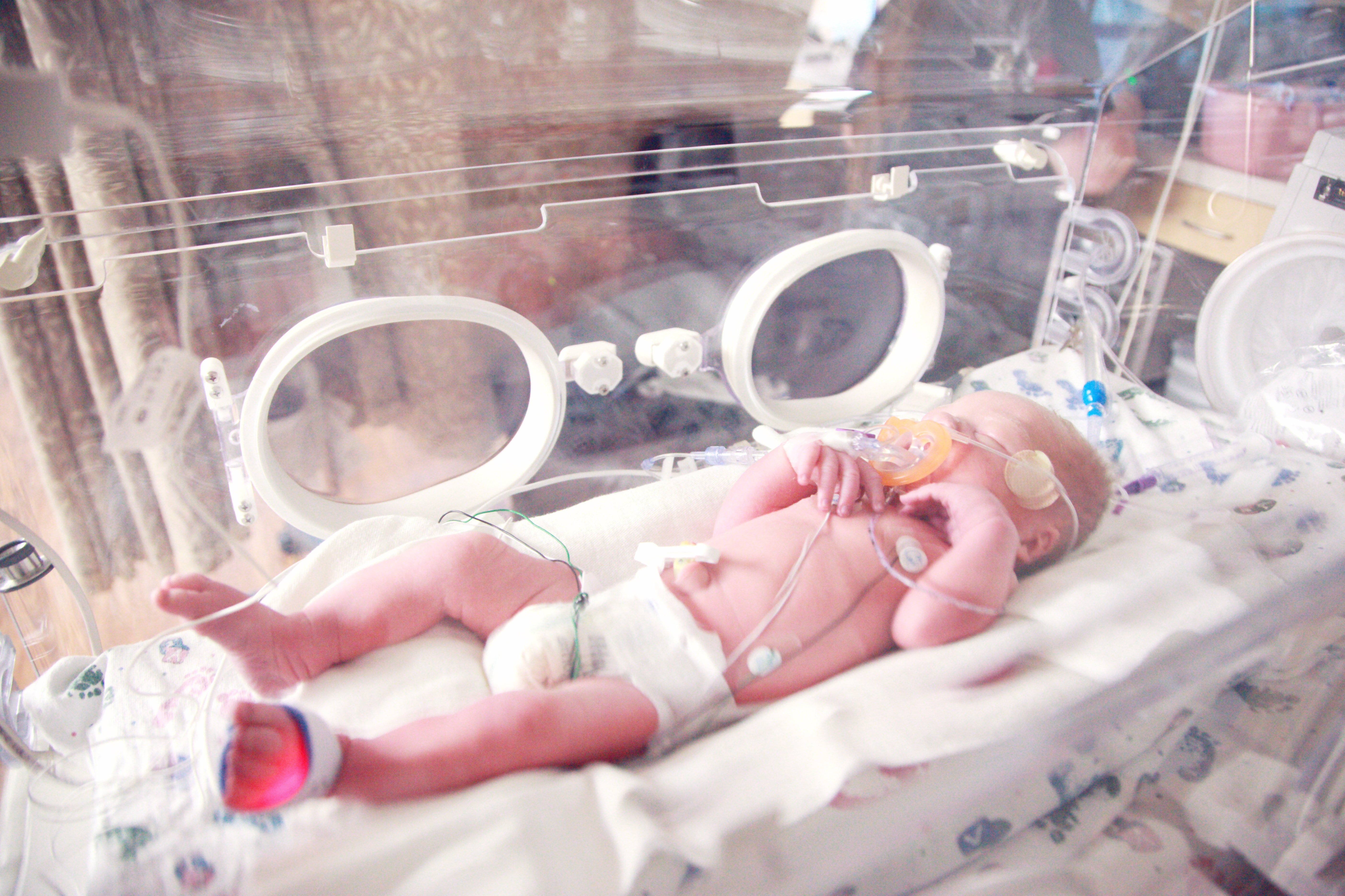 Un pequeño bebé en una incubadora. | Foto: Unsplash