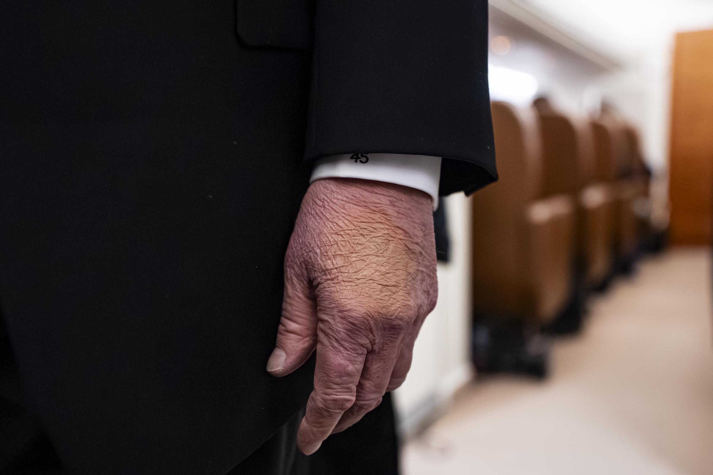 Donald Trump's hands as he speaks to reporters and members of the media on board Air Force One on January 31, 2026 while flying in between Washington and West Palm Beach, Florida | Source: Getty Images