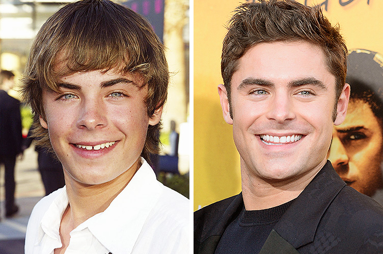 Zac Efron, July 14, 2004 | Zac Efron, August 20, 2015 | Source: Getty Images