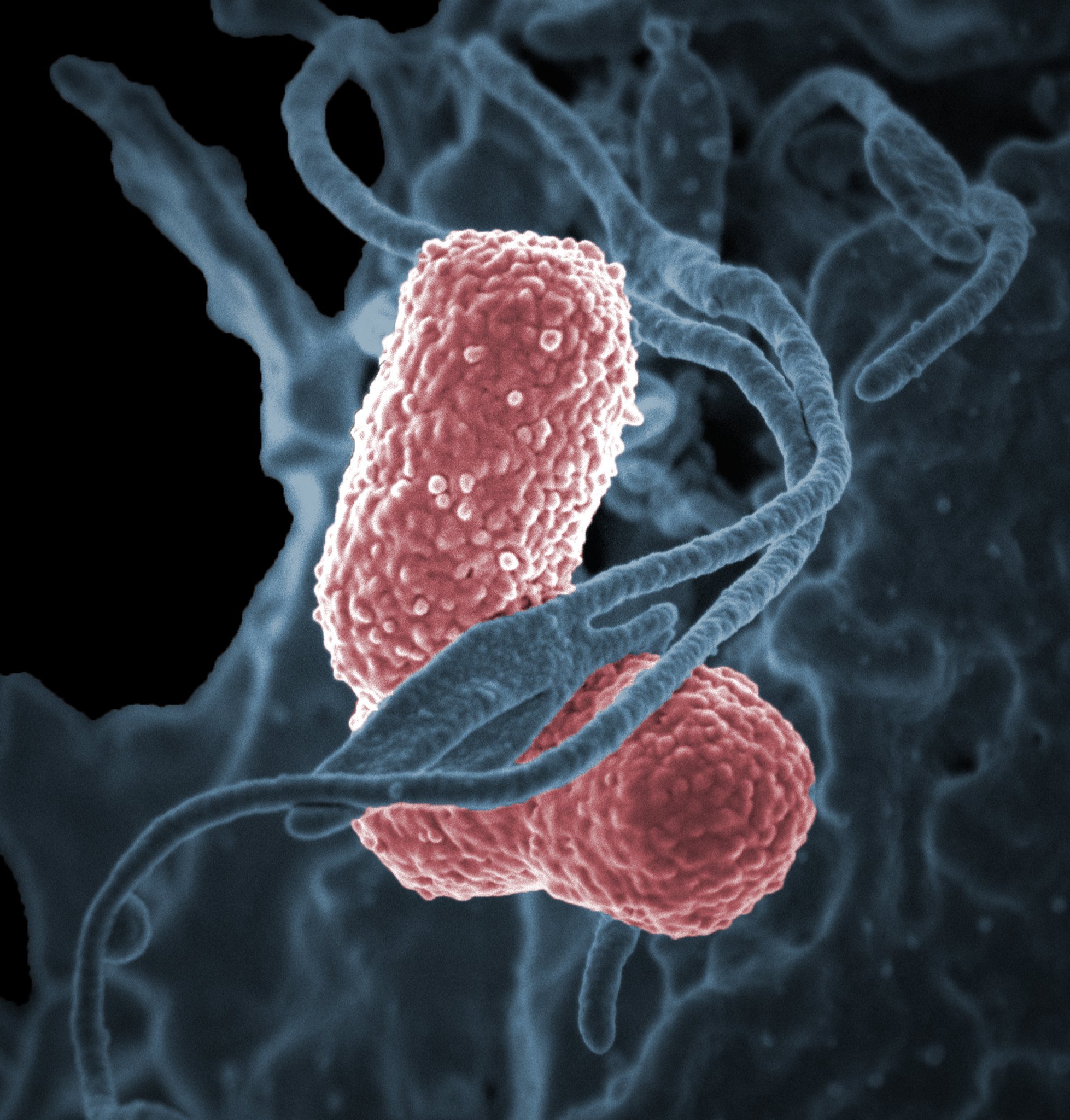 Bacteria Klebsiella pneumoniae. | Imagen: Flickr Bacteria Klebsiella pneumoniae. | Imagen: Flickr