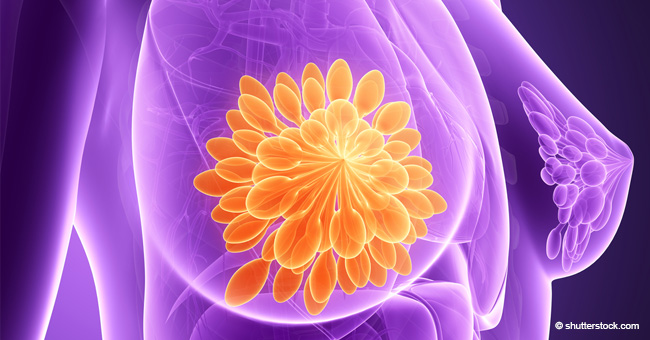 8 Symptome für Brustkrebs, die ohne erkennbaren Knoten in der Brust auftreten können