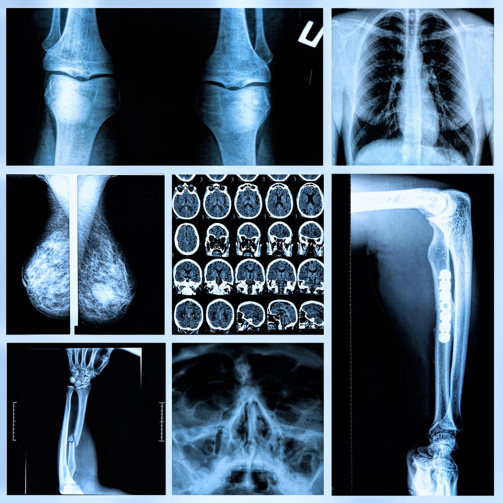 Radiografía de huesos.| Imagen tomada de: Shutterstock