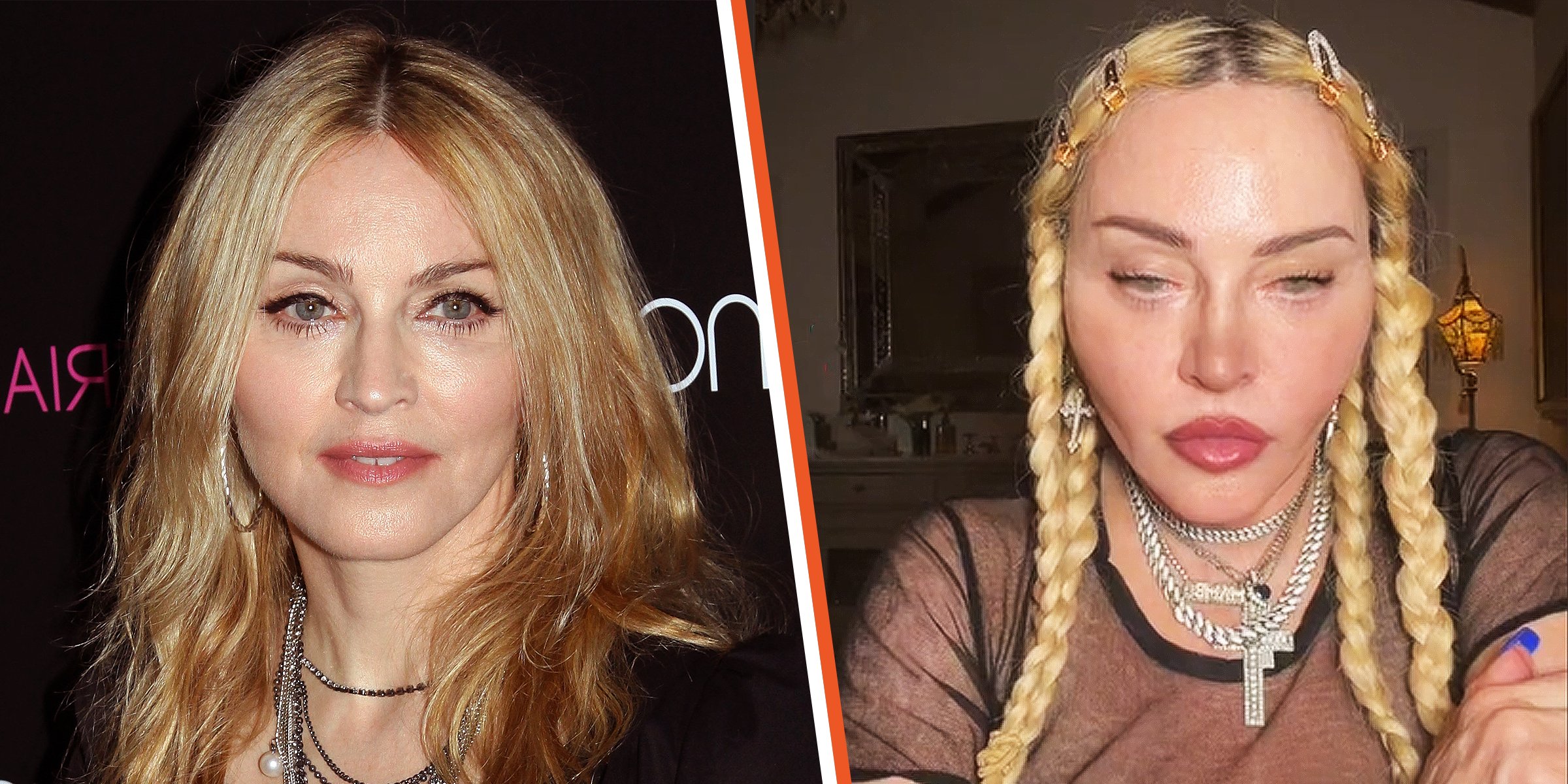 What Did Madonna Do to Her Face? The 63YearOld Singer Looks Youthful