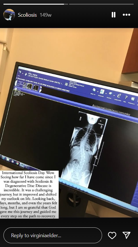 Virginia Elder reflects on her scoliosis diagnosis and recovery after years of treatment and faith-led resilience. | Source: Instagram/virginiaelder