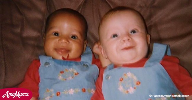 Famous twins with opposing skin color are all grown up and they couldn't look more different