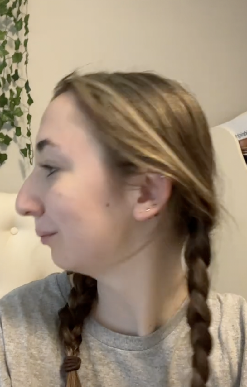 A screenshot of Maddie before undergoing double jaw surgery from a post dated October 24, 2023. | Source: TikTok/maddieakamofo