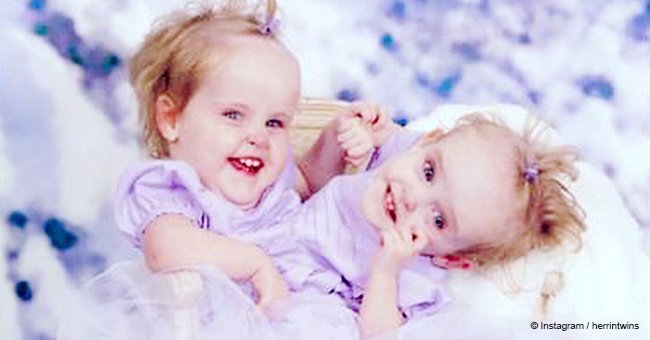 Remember conjoined twins Kendra and Maliyah? They are no longer little kids and look great