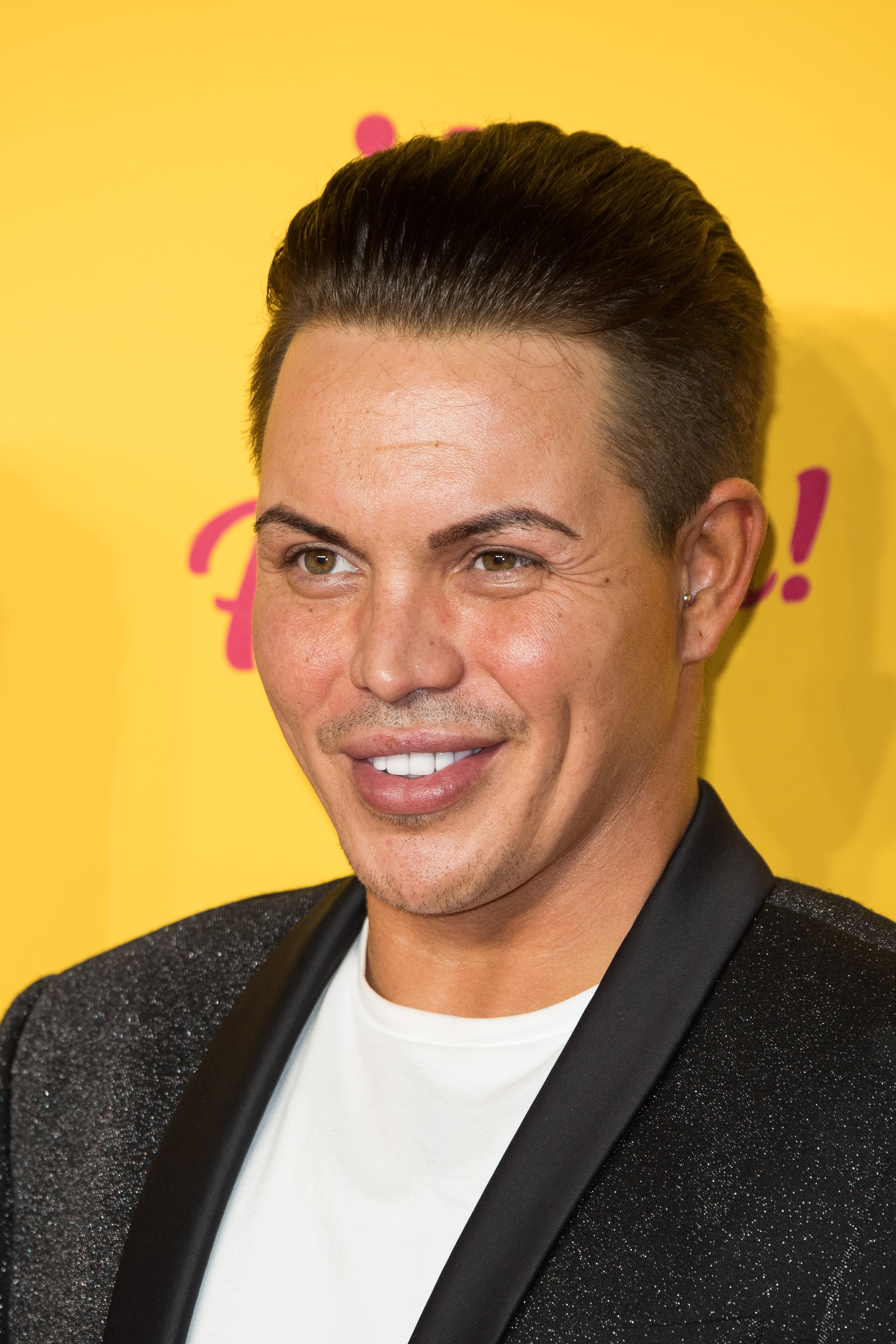 At the ITV Palooza! in October 2018, Norris posed against a vivid yellow backdrop in a sparkly black blazer and white tee, his complexion smooth and his features fuller and more sculpted than in his earlier "Towie" days.