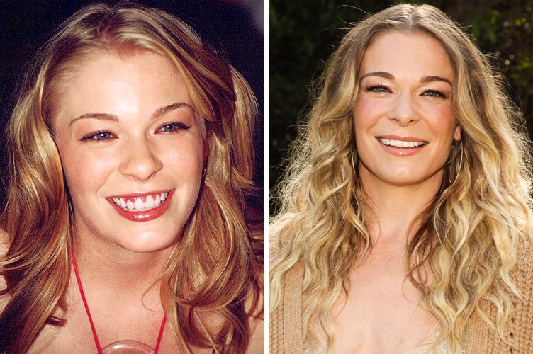 Leann Rimes avant et après. ǀ Source : Getty Images