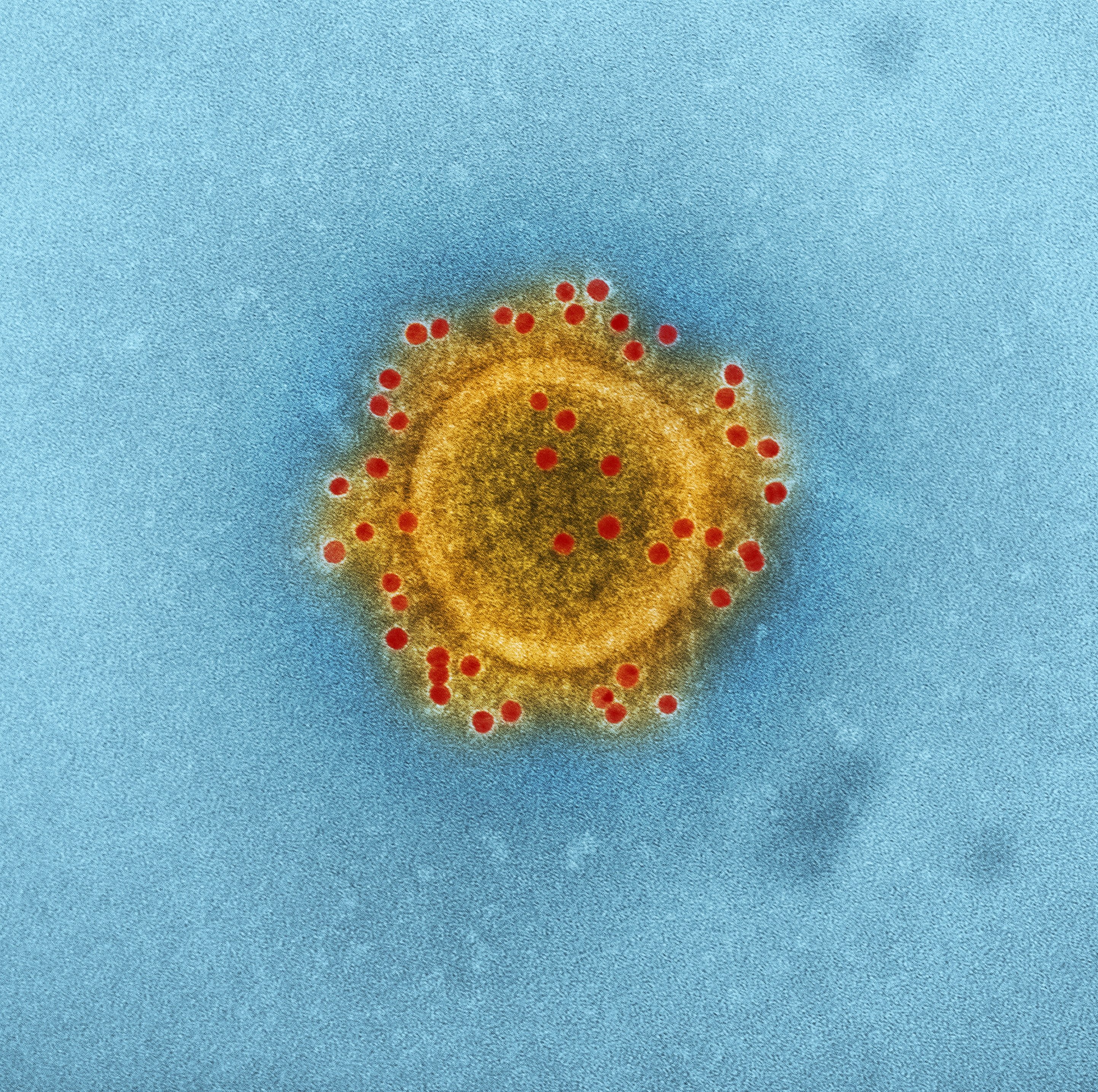 Up close photo of a virus cell | Photo: Unsplash