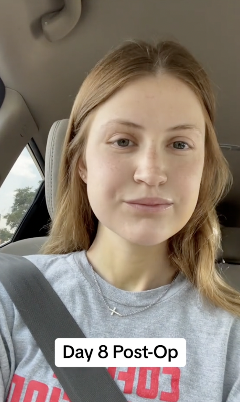 In the car, Virginia Elder shares her first public selfie since surgery. | Source: TikTok/virginiaeelder