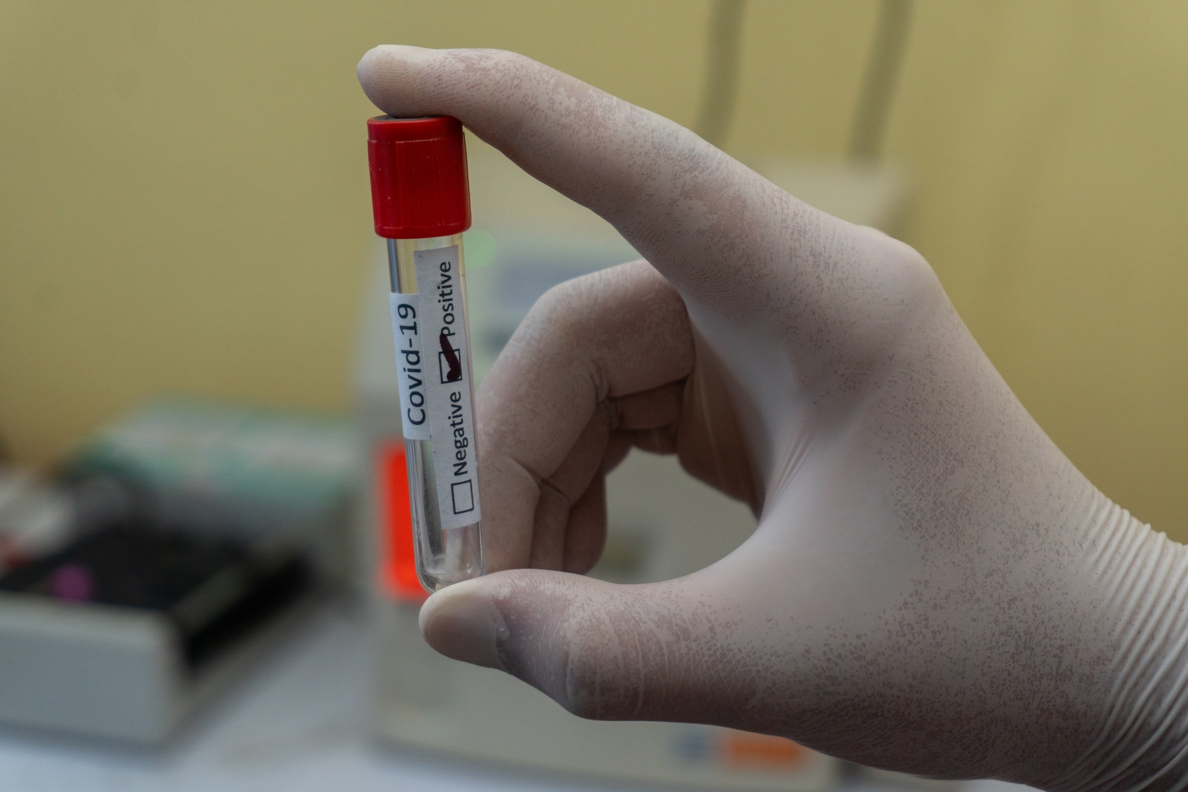 A person holding a sample that tested positive for Covid-19. | Source: Unsplash
