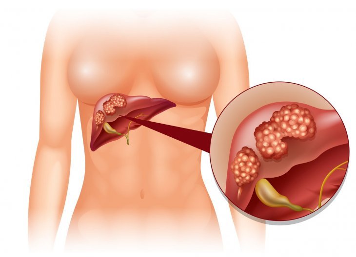 Imagen tomada de: Shutterstock Imagen tomada de: Shutterstock