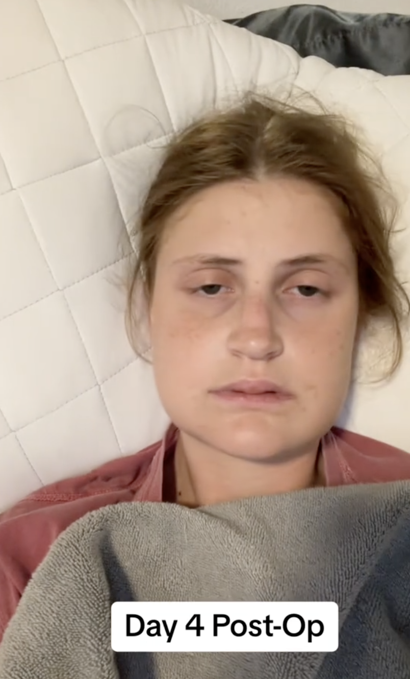 Virginia Elder at home, resting quietly on Day 4 of post-op recovery. | Source: TikTok/virginiaeelder