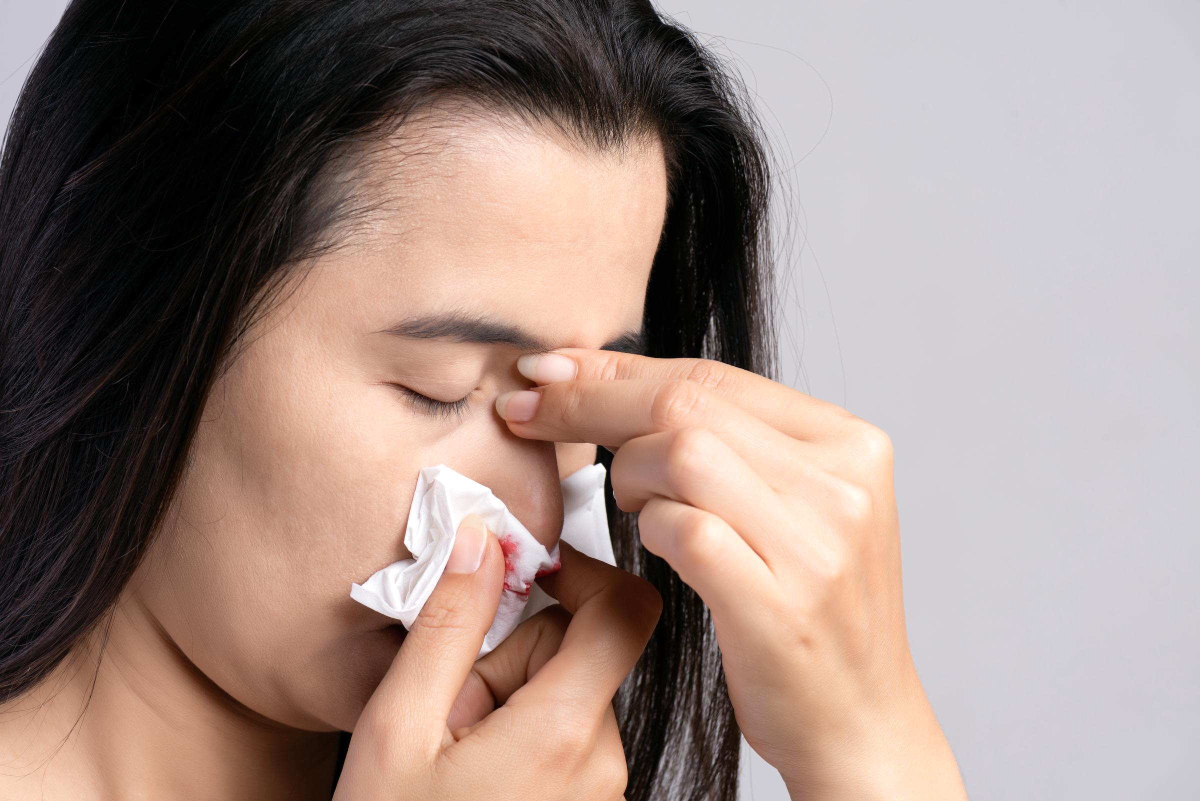 A young woman suffering from a nosebleed | Source: Getty Images
