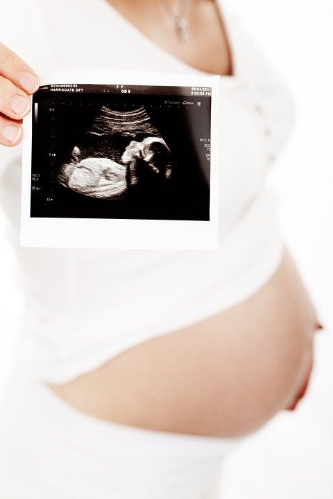 Mamá mostrando el ultrasonido de su bebé| Foto: Pixabay Mamá mostrando el ultrasonido de su bebé| Foto: Pixabay