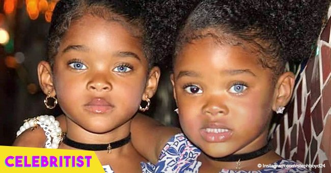 Blue-eyed twins who were 'the most beautiful twins in the world' are ...