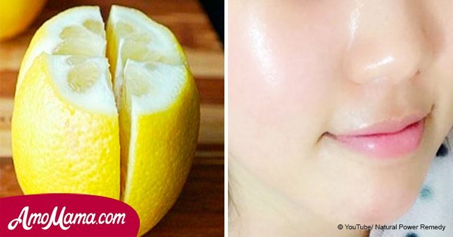 Do you need to remove spots from your face? Just use a lemon