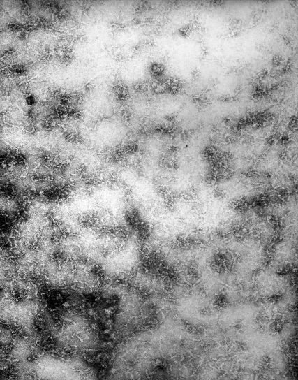 Visualización microscópica de una muestra del virus de encefalitis de La Crosse. | Imagen: Flickr