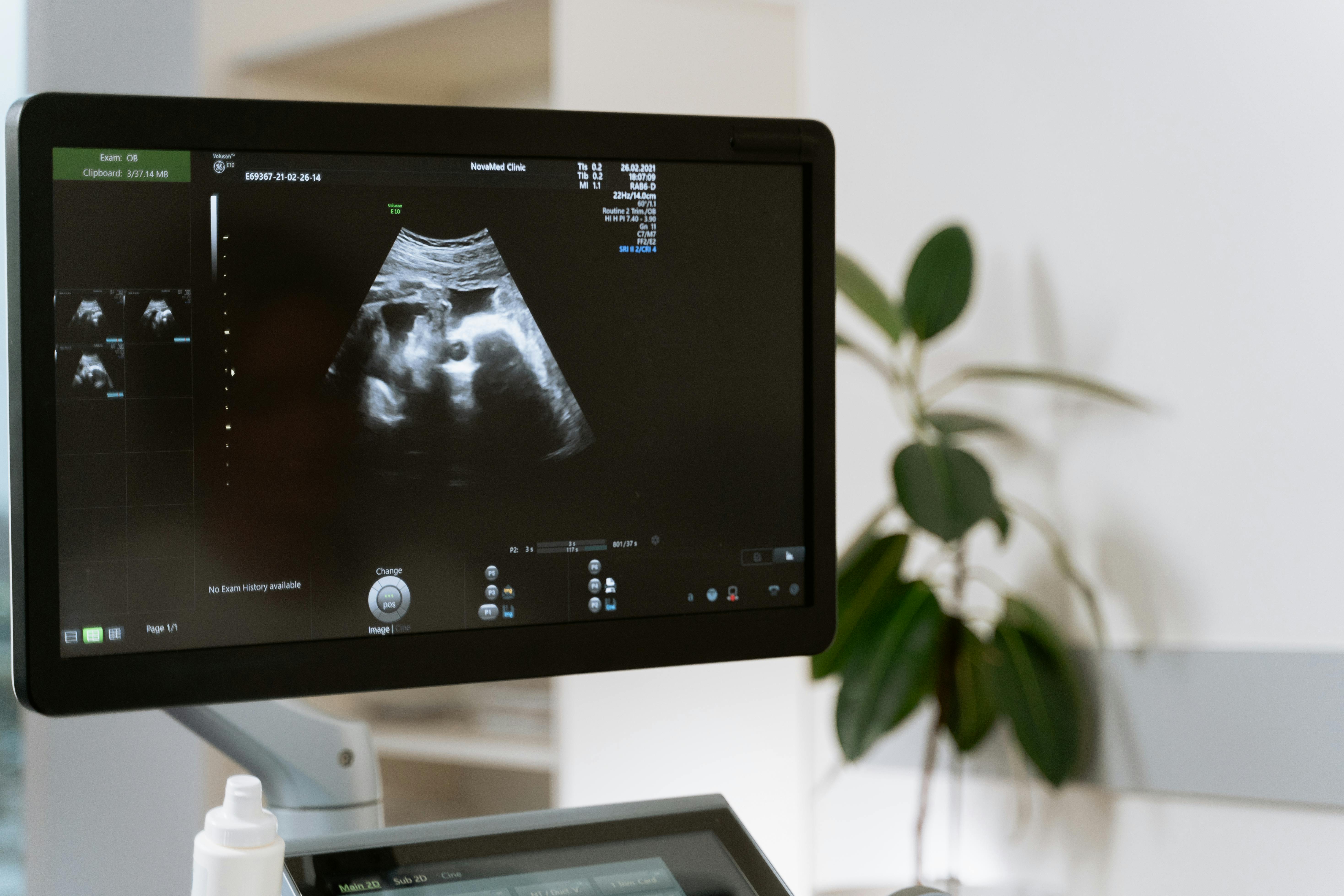 A close-up of an ultrasound | Source: Pexels