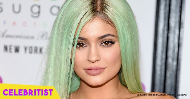 Kylie Jenner shares first pictures after removing lip fillers