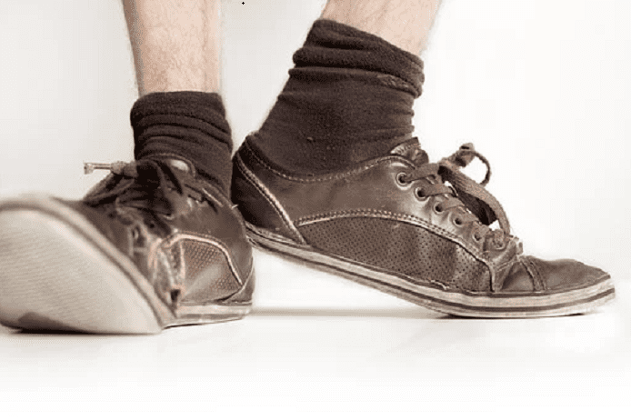 Medias viejas y estiradas. | Foto: Pixabay.