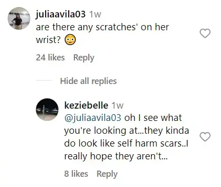A screenshot of Instagram comments from concerned fans as Suri Cruise appeared to have scratches on her wrist. | Source: instagram.com/@suricruise_sc