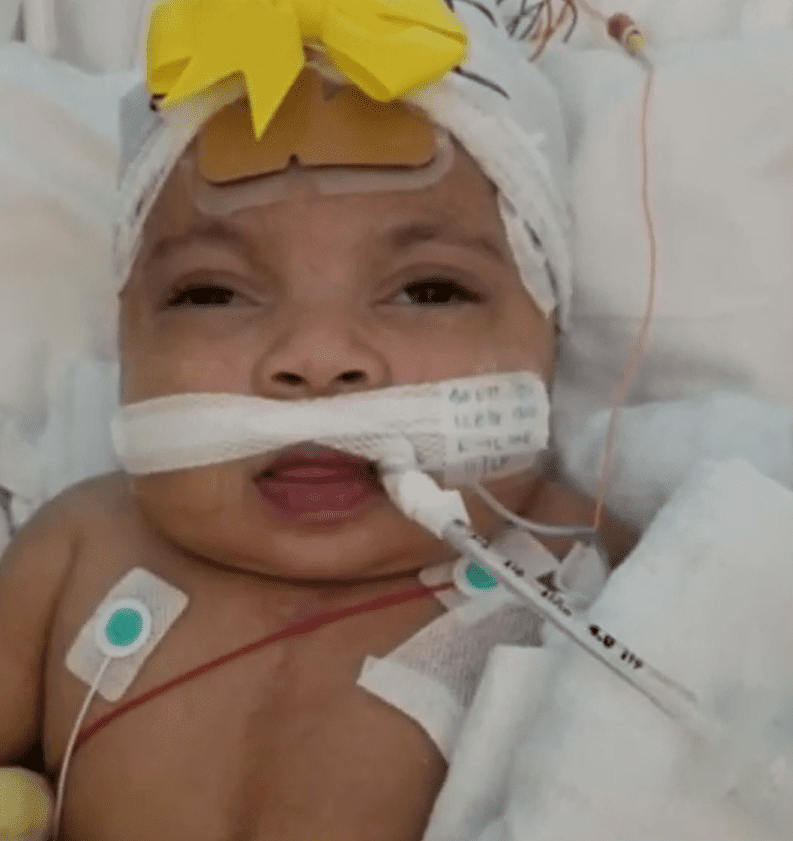 Baby Phoenix receiving treatment at the hospital. | Source: youtube.com/CBS Miami