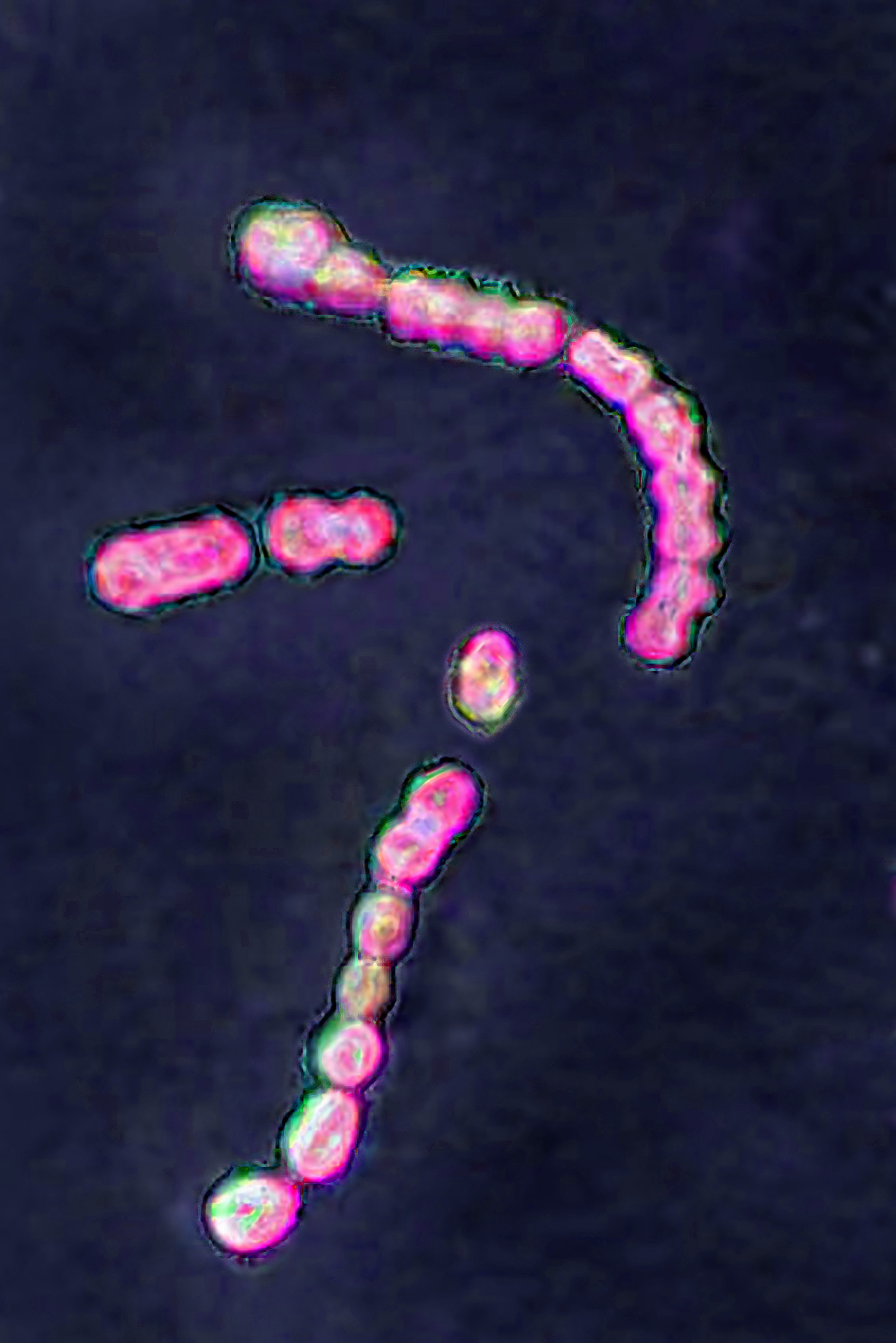 Optical microscopy image of group A Streptococcus pyogenes, the bacterium linked to strep throat and other serious infections | Source: Getty Images