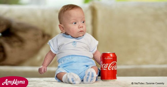 Britain's smallest baby has survived despite being the size of a soda can at birth