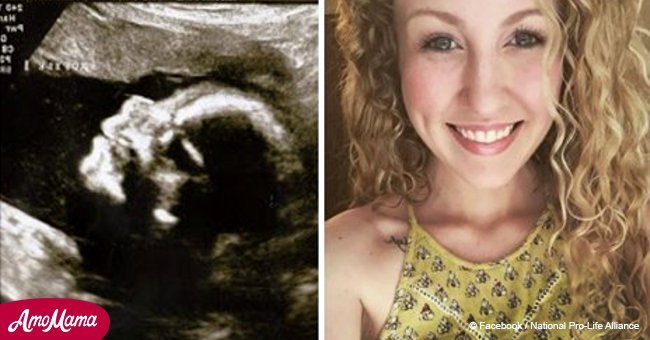 Woman was nervously waiting for her 18-week ultrasound. But doctor destroyed her dreams