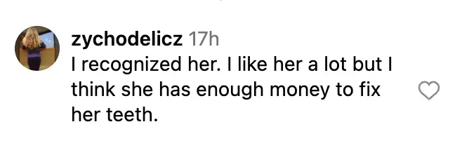A screenshot of a comment on Facebook expressing admiration for Kate Moss but also raising the question about her stained teeth. | Source: facebook.com/DailyMail