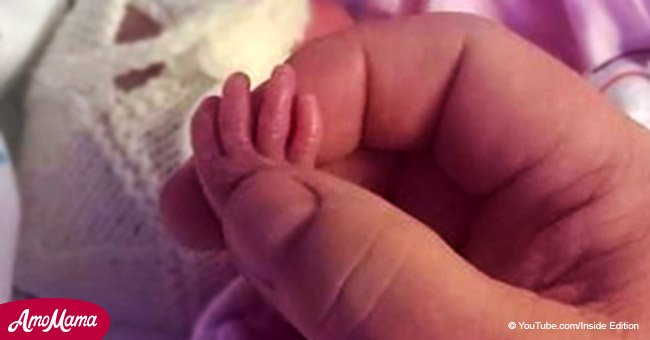 Premature baby born days after 24-week abortion limit surprises doctors with her progress