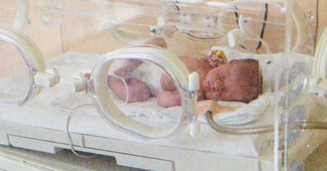 Un bebé prematuro intenta sobrevivir en una incubadora. | Foto: Shutterstock