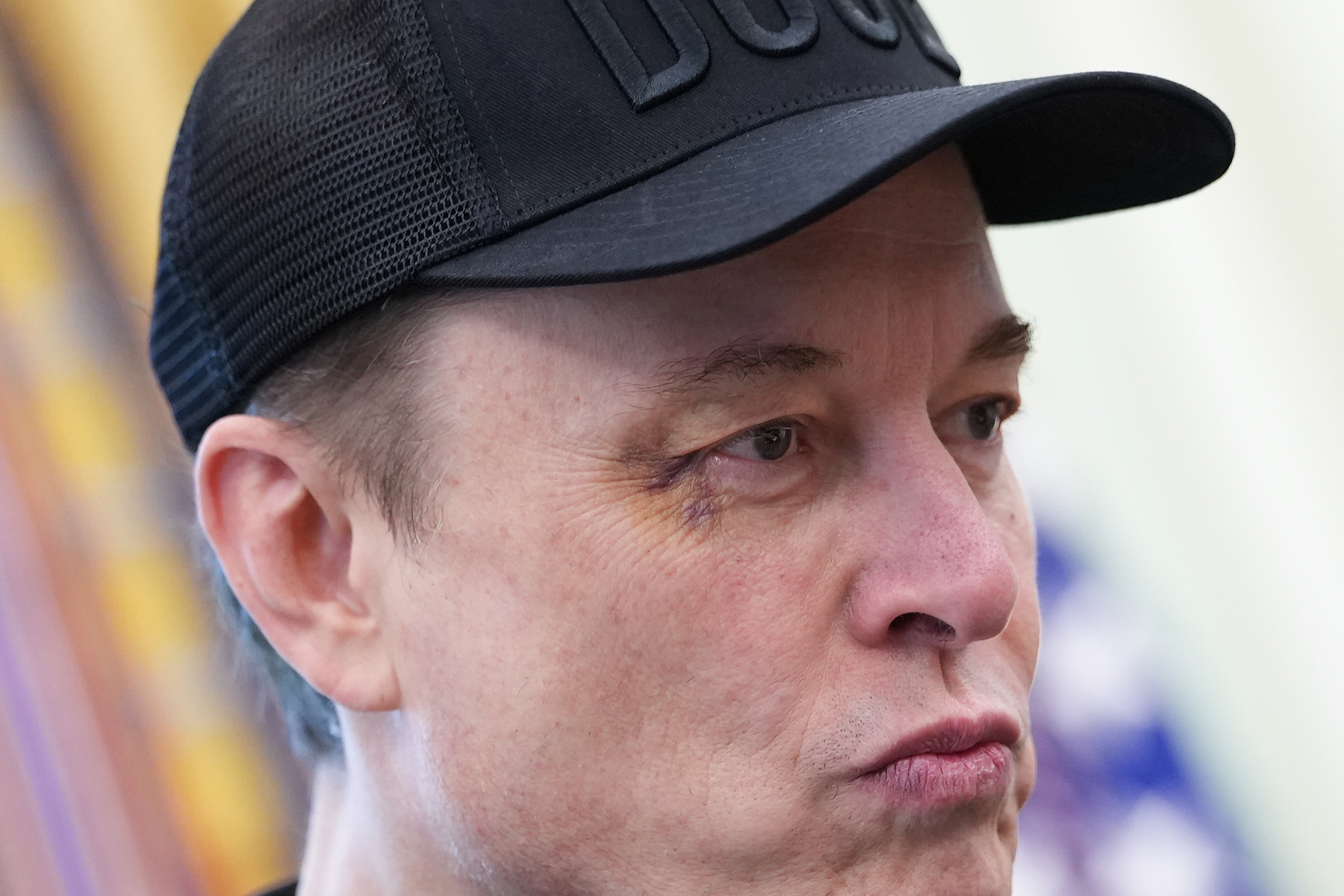 Whether caused by playtime or something else, Musk's final appearance in the Trump administration left a mark — quite literally.