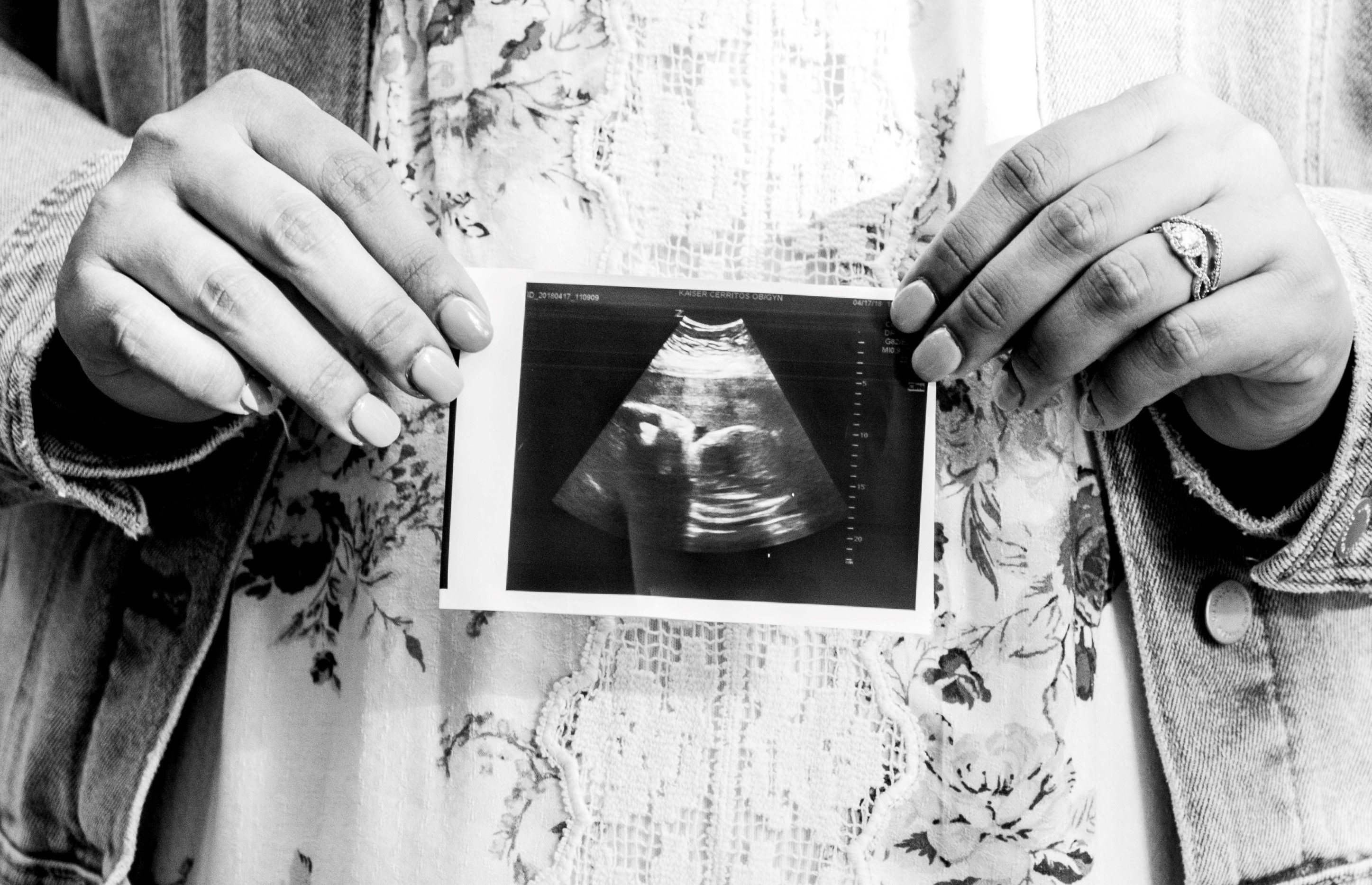 OP's in-laws claimed they suspected OP was pregnant & were looking for ultrasound photos. | Source: Unsplash