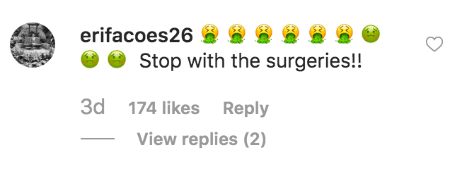 Fan encourages Kylie to stop having plastic surgery done on her body | Source: instagra.com/kyliejenner