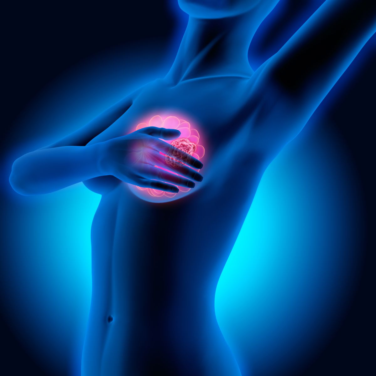 Image illustrant le cancer de seins. | Photo : Getty Images