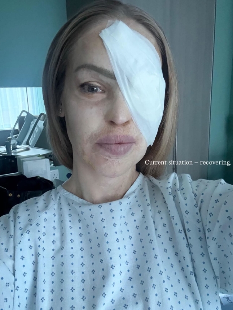 Katie Piper photographed in her hospital gown following one of her many surgical procedures in a post dated 11 December 2025.  | Source: Facebook/Katie Piper