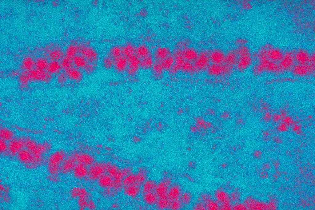 Imagen del virus de la encefalitis japonesa bajo el microscopio. | Imagen: Flickr Imagen del virus de la encefalitis japonesa bajo el microscopio. | Imagen: Flickr