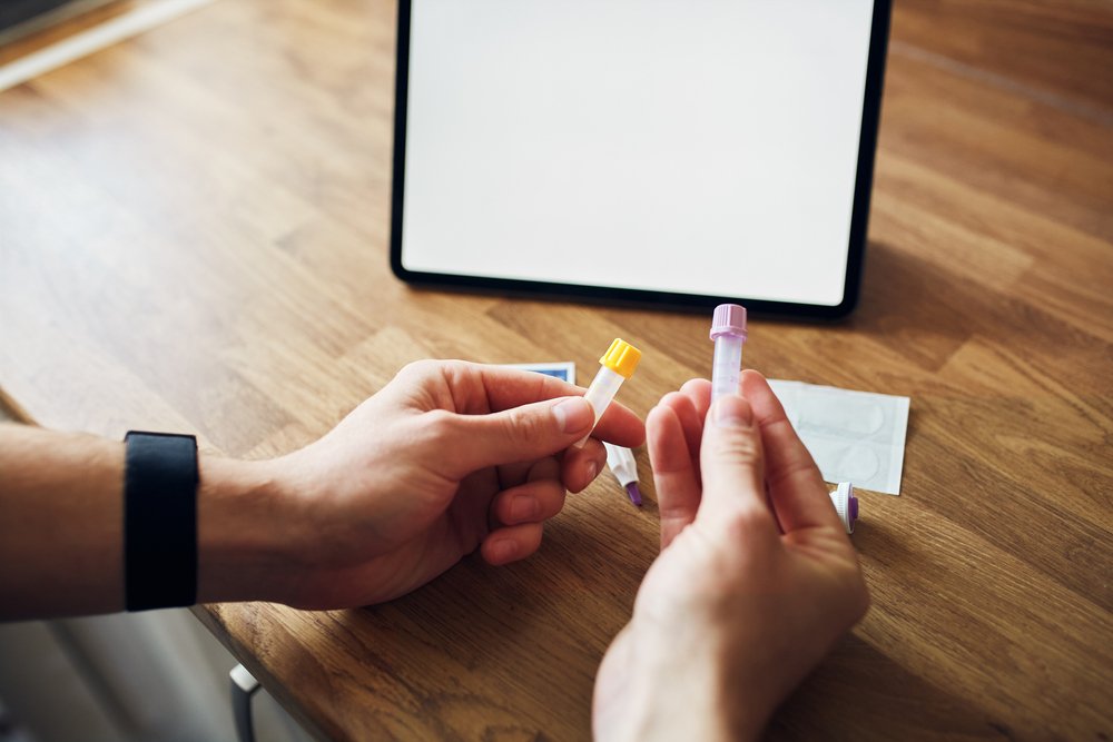 Frascos de muestra para un test. | Foto: Shutterstock